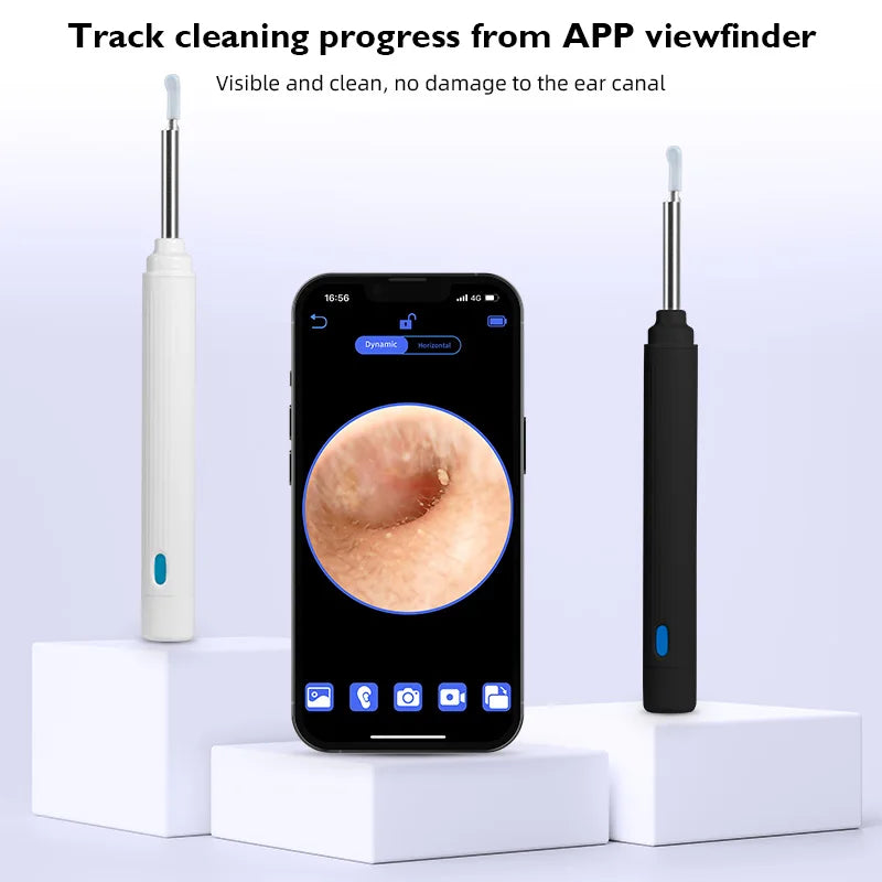 KERUI 5MP Smart Visual Ear Otoscope – HD Endoscope & Earwax Removal Tool