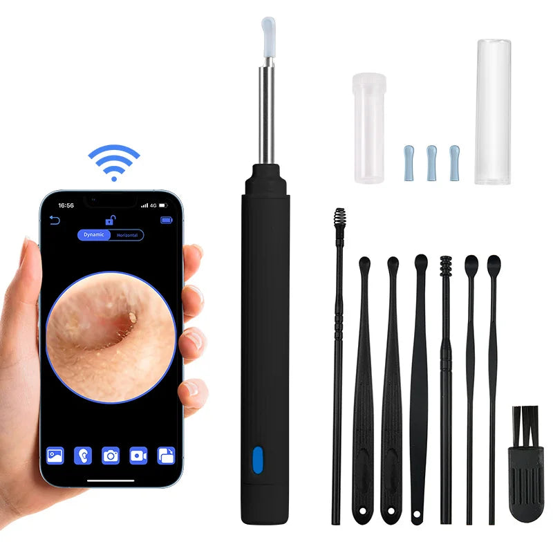 KERUI 5MP Smart Visual Ear Otoscope – HD Endoscope & Earwax Removal Tool