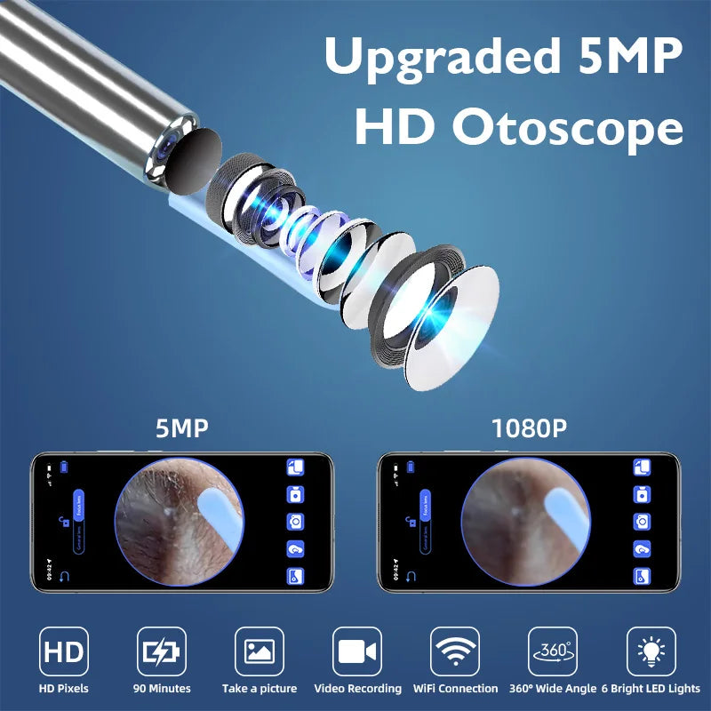 KERUI 5MP Smart Visual Ear Otoscope – HD Endoscope & Earwax Removal Tool